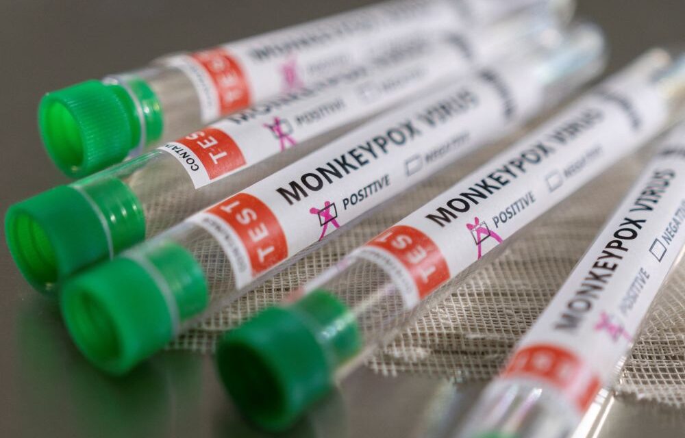 Španielsko začne očkovať proti opičím kiahňam blízke kontakty nakazených